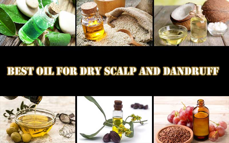 Best-Oil-For-Dry-Scalp-And-Dandruff